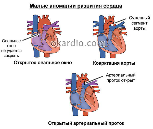 Овальное окно у младенца: возможные проблемы с сердцем, их симптомы и лечение
