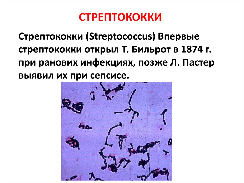 Стрептококковая инфекция: откуда берется, диагностика и чем лечить?