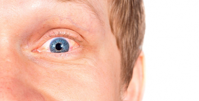 Эписклерит глаза: причины, симптомы, диагностика и лечение