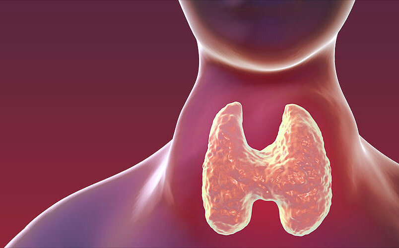 Аутоиммунный тиреоидит щитовидной железы: что это такое