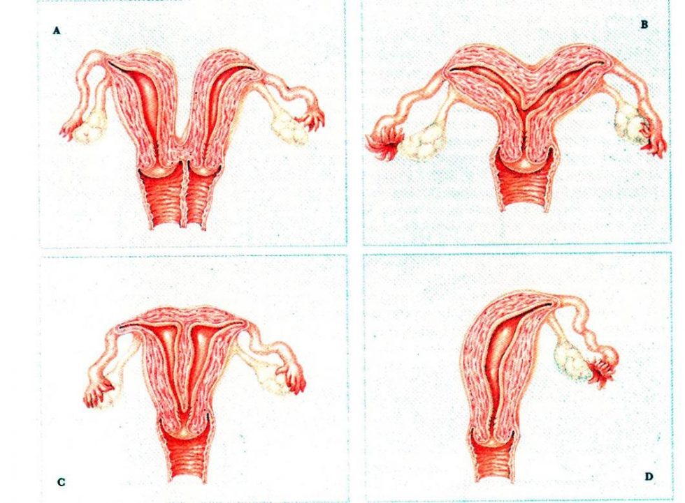 Синехии половых губ у девочек: как распознать и чем лечить