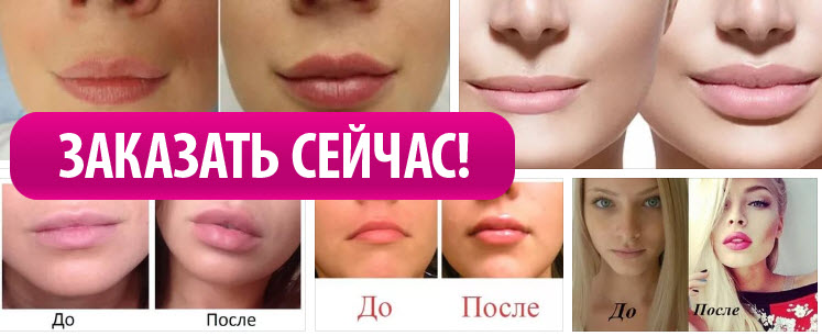 Красивые малые половые губы. фото до и после лабиопластики