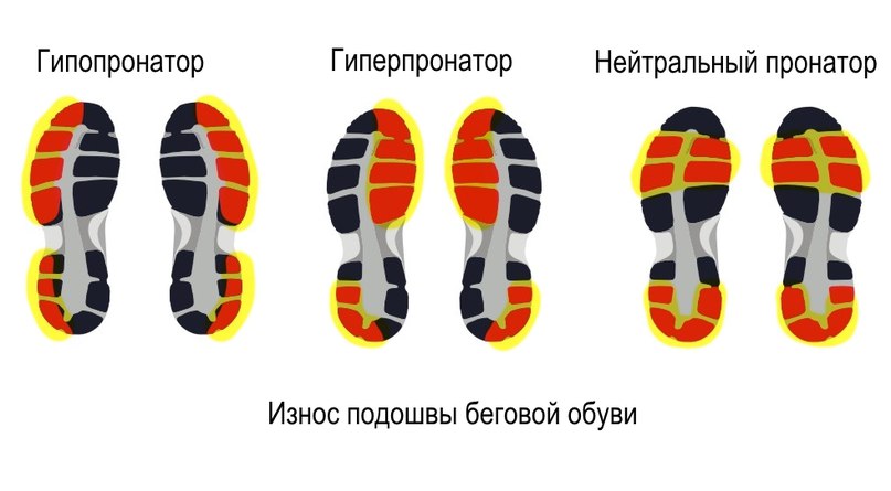 Кроссовки с гиперпронацией