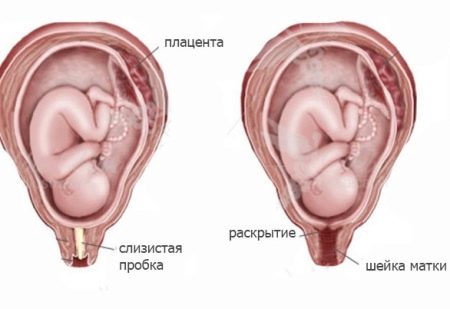 Цервикометрия при беременности – что это такое и как проводится?