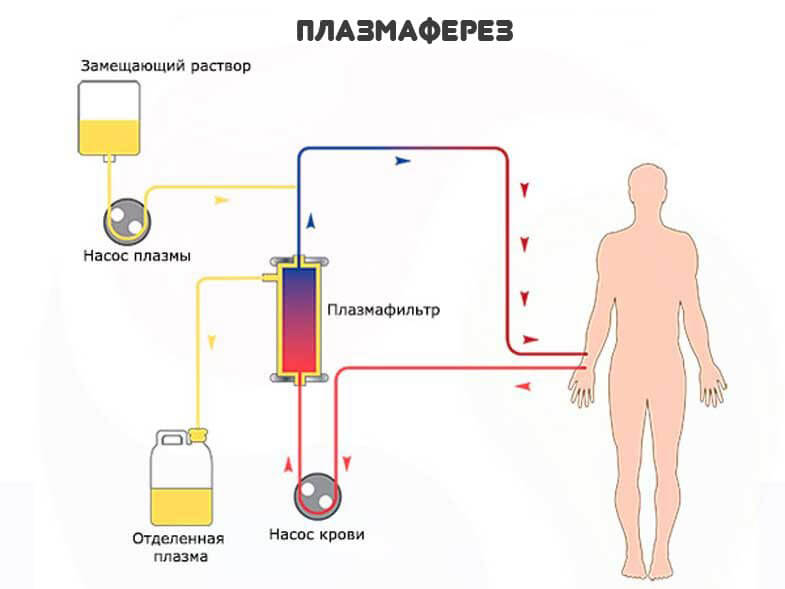 Плазма крови: что это, состав и функции, заболевания, влияющие на свойства плазмы