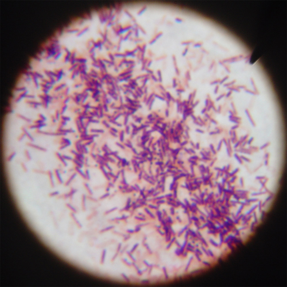 Бациллюс субтилис (bacillus subtilis, сенная палочка): биохимические свойства, выращивание и применение