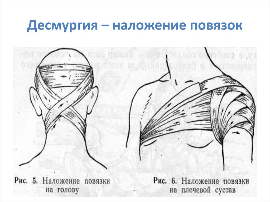 Десмургия презентация по хирургии