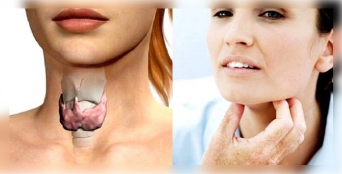 Диффузные изменения щитовидной железы: признаки, лечение