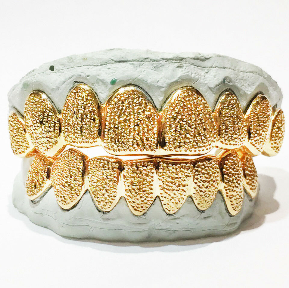 Что такое грилзы на зубы и для чего они нужны