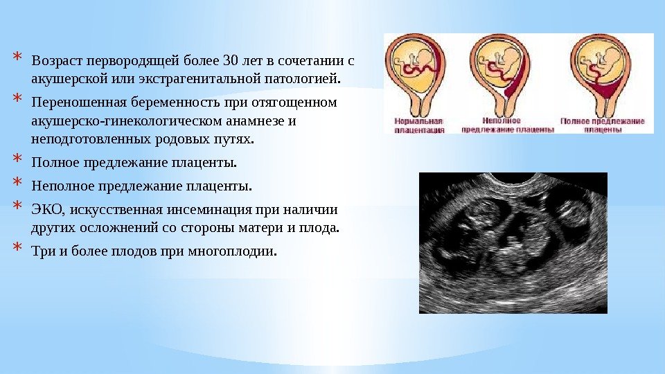 Расшифровка результатов узи при беременности, таблица – портал для мам, отзывы