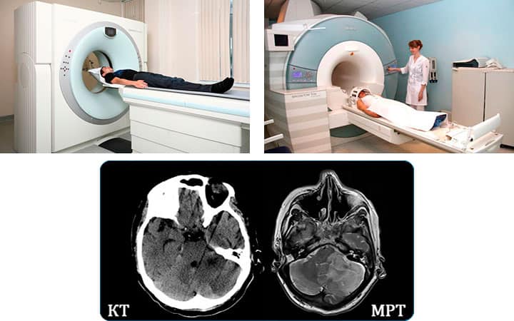 Магнитно-резонансная томография комплексная для женщин — подробное описание с адресами клиник