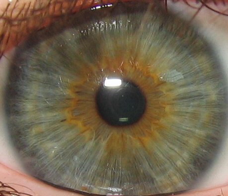 Радужка глаза: строение, функции, болезни - "здоровое око"