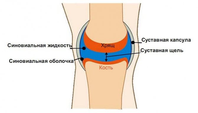 Синовит коленного сустава: симптомы, фото, лечение. как лечить синовит