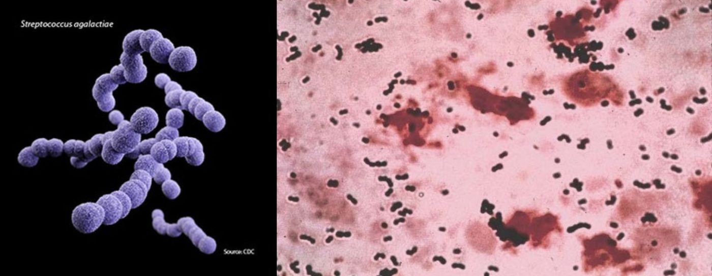 Streptococcus mitis (стрептококк митис): особенности, диагностика, лечение