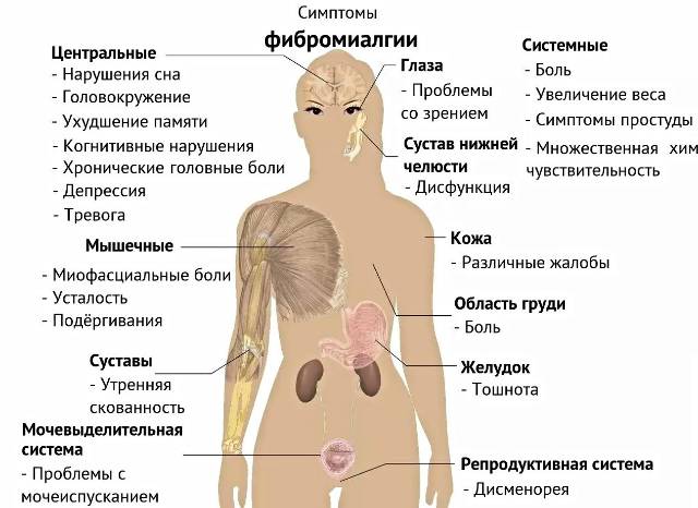 Фибромиалгия: симптомы и лечение в домашних условиях