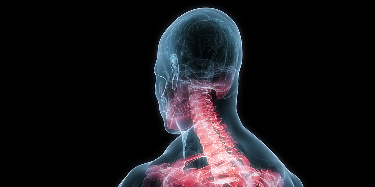Острая боль в шее или цервикалгия, кто находится в зоне риска?