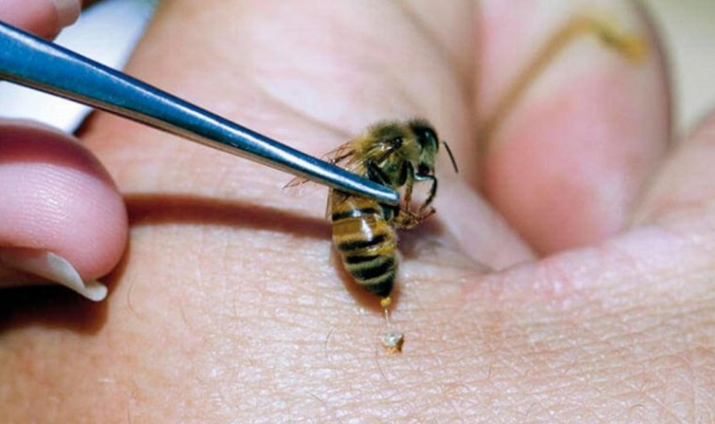 Лечение пчелиными укусами и пчелопродуктами