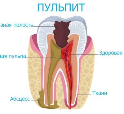 2.клеточный состав пульпы зуба. клеточные слои.