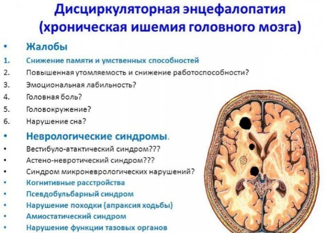 Энцефалопатия на фоне церебрального атеросклероза