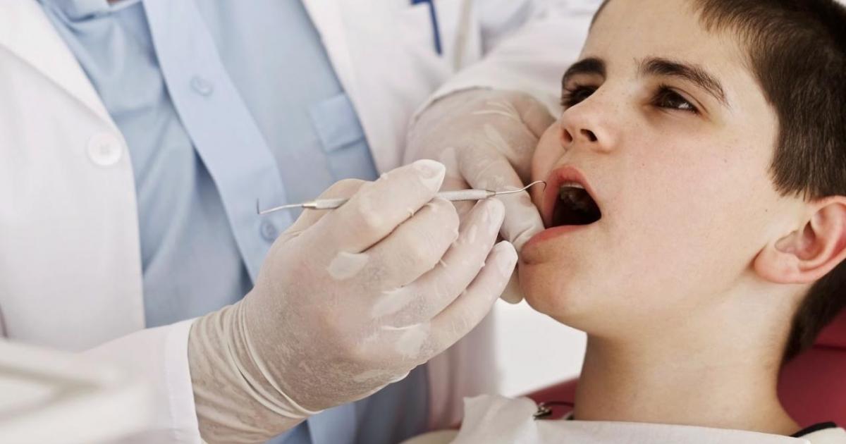 Санация полости рта: что это и кому проводится - много зубов