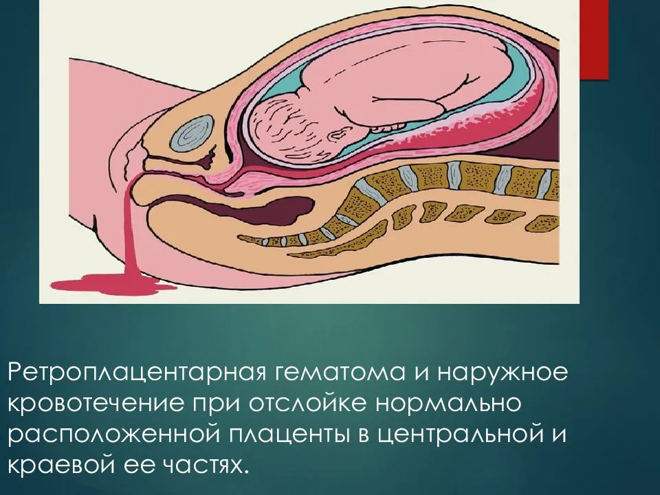 Плацента человека: что это, как она выглядит, её строение, структура и функции, что такое послед и детское место