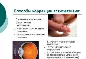 Смешанный астигматизм у детей — причины, симптомы и лечение