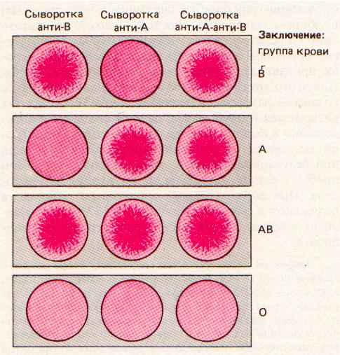 Переливание крови - правила. совместимость групп крови при переливании и подготовка пациента к гемотрансфузии