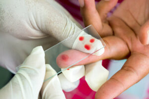 Mpv в анализе крови: что это такое, норма у взрослых