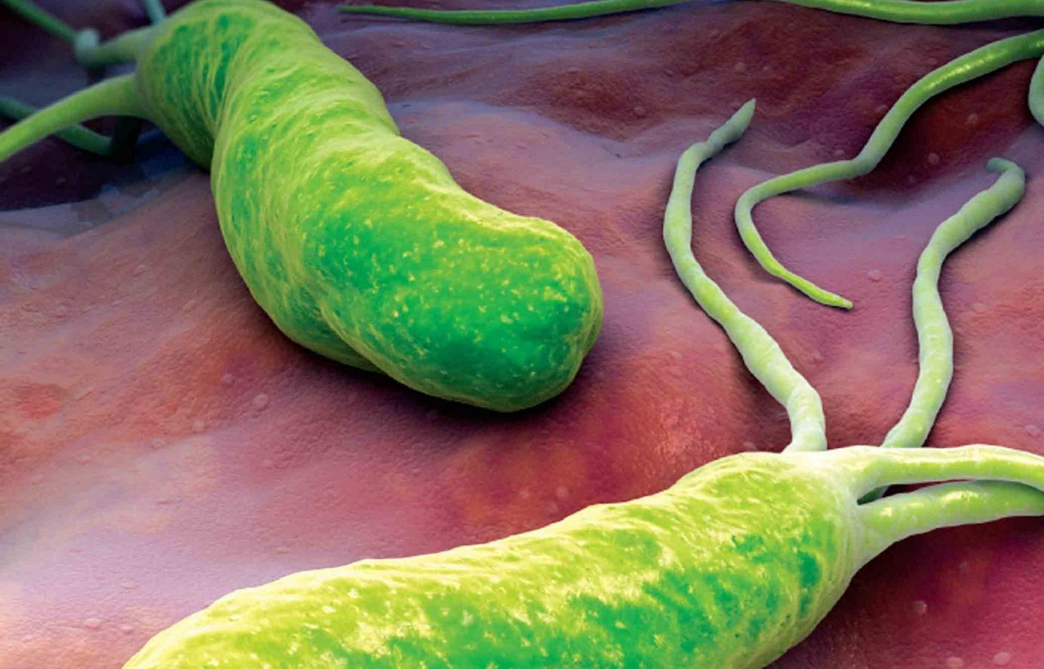 Что предлагает медицина для борьбы с helicobacter pylori