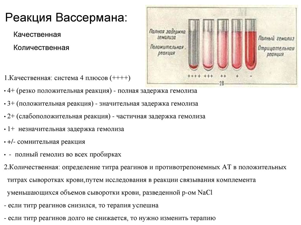 Схема лабораторной диагностики сифилиса