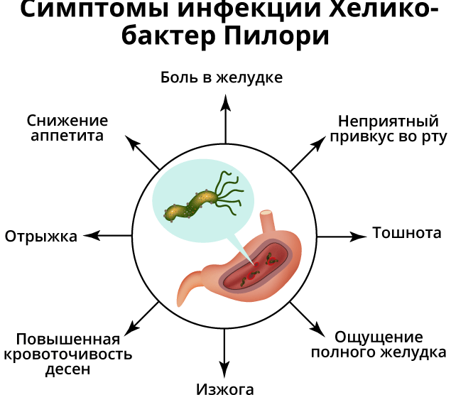 Эрадикация helicobacter pylori