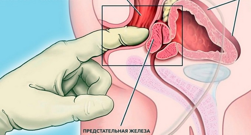 Что собой представляет и где находится простата у мужчины (о симптомах и лечении с фото)