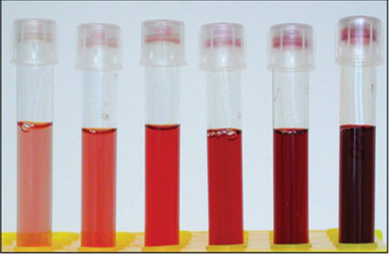 Гемолиз крови при сдаче анализов: что это такое и что это значит?
