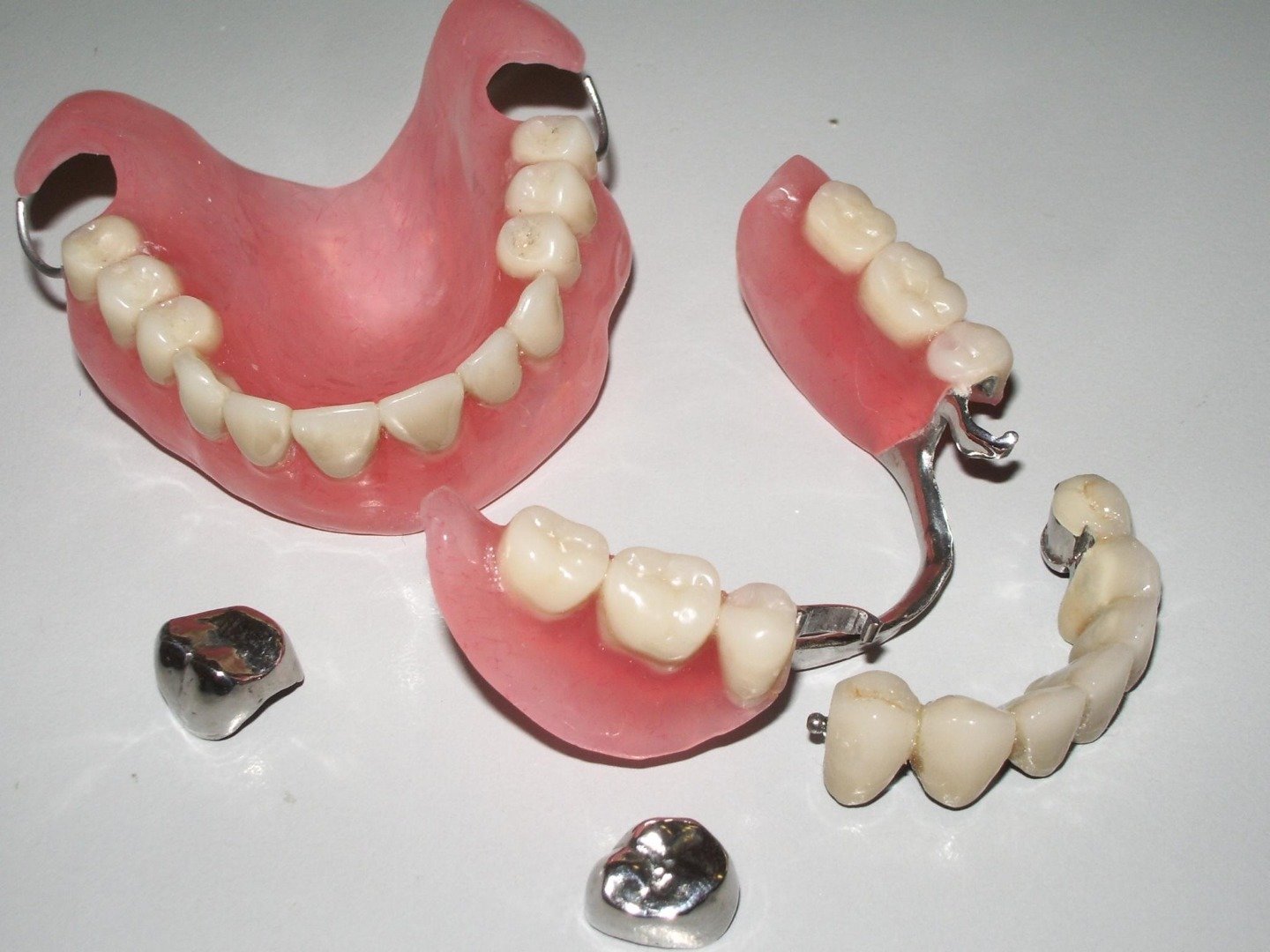 Зубные бюгельные протезы – отзывы, цена на протезирование, фото