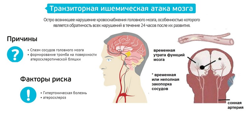 Ишемическая болезнь сосудов головного мозга - симптомы и причины