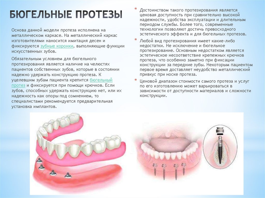 Что такое бюгельный протез: цена, фото, отзывы. съемное бюгельное зубное протезирование на верхнюю, нижнюю челюсть в москве || ставрополь