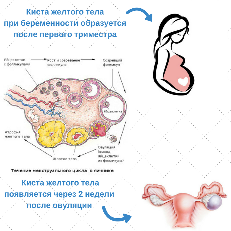 Желтое тело на узи обследовании яичников: характеристики, показатели и нюансы диагностики