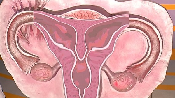 Двурогая матка — что это такое? беременность и роды, лечение и виды аномалии