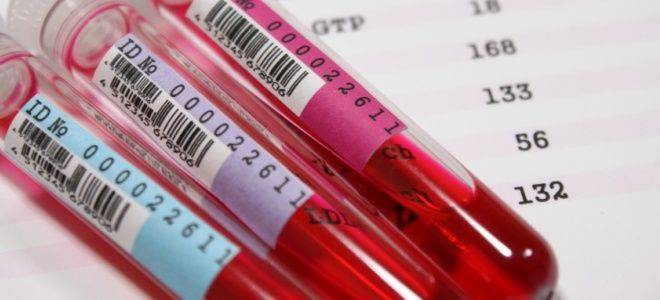 Как обозначаются тромбоциты в анализах крови - расшифровка результатов, норма и повышенный уровень
