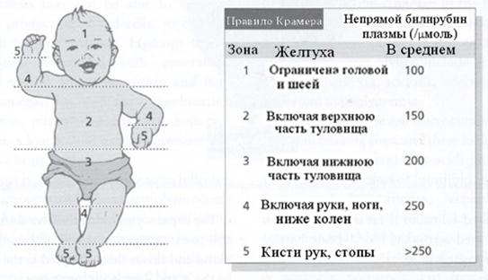 Билирубин общий повышен