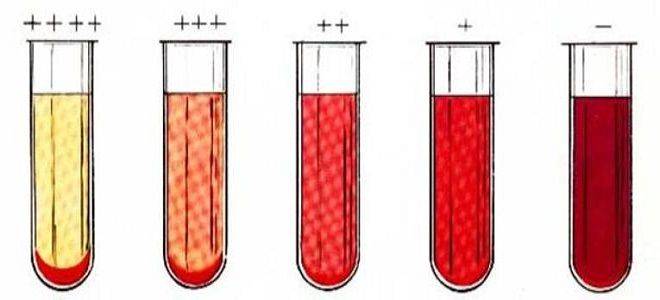 Анализ крови на сифилис (rw) (реакция вассермана)