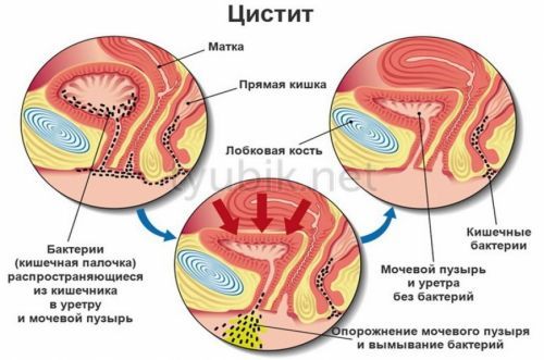 Кыст аль-хинди