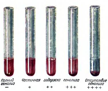 Гемолиз эритроцитов: что это такое, виды и где происходит, нормы в анализе крови, причины повышения и уменьшения значений