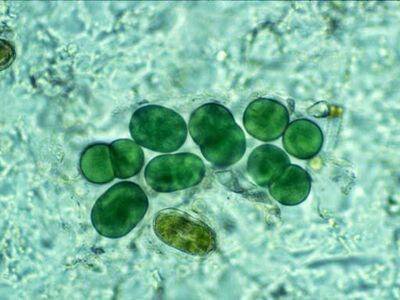 Цианобактерии — википедия. что такое цианобактерии