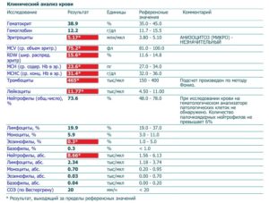 Базофилы повышены у взрослого: о чем это говорит?