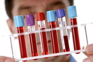 АЛТ и АСТ анализ крови показания к проведению
