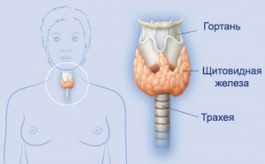 Хронический тиреоидит щитовидной железы: что это такое, лечение, симптомы