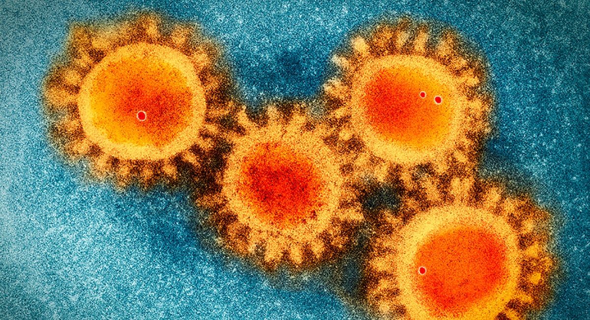 Суть коронавируса: sars-cov-2, когда будет вакцина