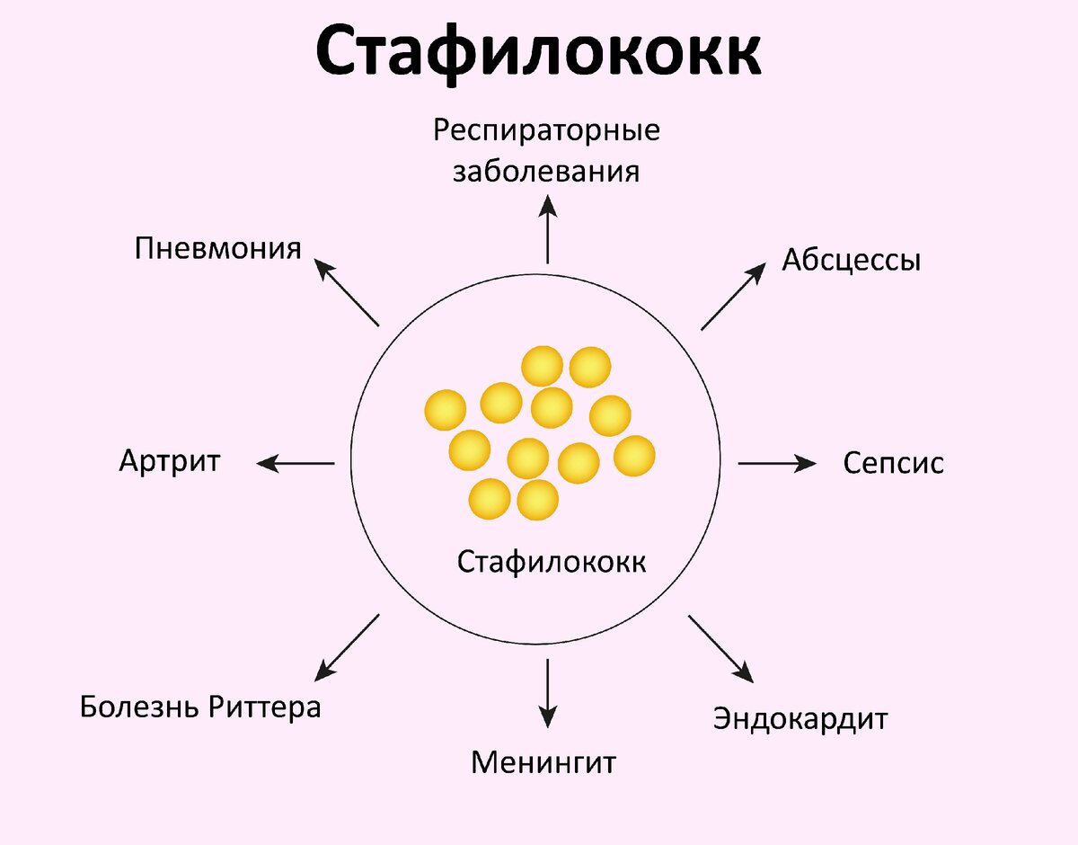 Стафилококк эпидермис 10 в 3 степени — vospaleniekishechnika