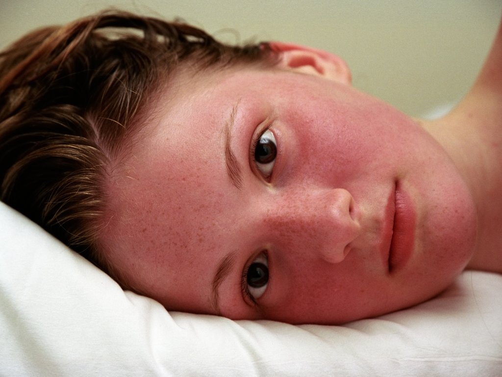 Гиперемия кожи, конъюнктивы, слизистых, зева: что это такое, признаки и причины, симптомы и лечение
